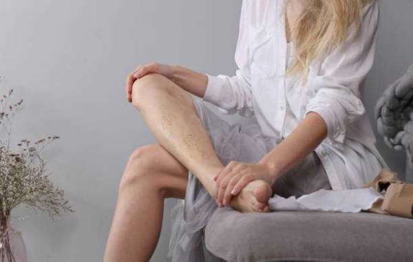 Safe and effective spider veins removal in Abu Dhabi