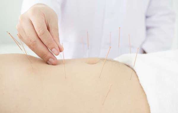 How Acupuncture Targets Metabolism for Weight Loss