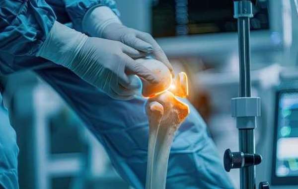 Arthroscopic Knee & Shoulder Surgery in Lahore | OrthoCenter - Expert Care at the Best Cost