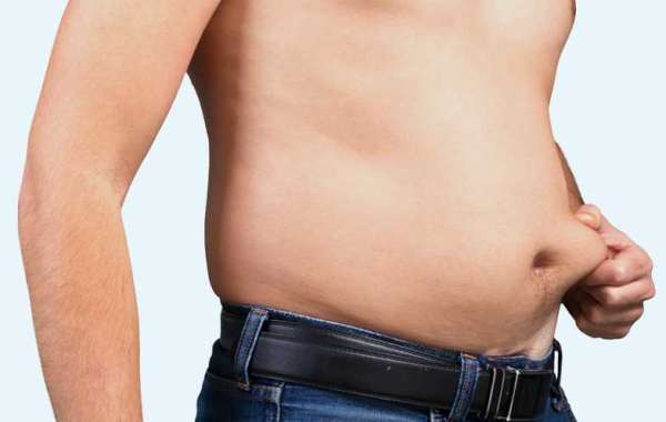 Understanding Liposuction Surgery in Pakistan What You Need to Know